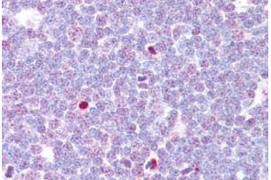 Anti-CAMK4 antibody IHC staining of human thymus. (CAMK4 antibody  (AA 166-215))