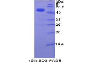 SDS-PAGE analysis of Human TFAM Protein.