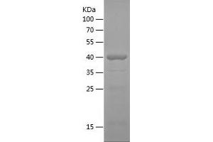 CTNNA2 Protein (AA 493-858) (His tag)