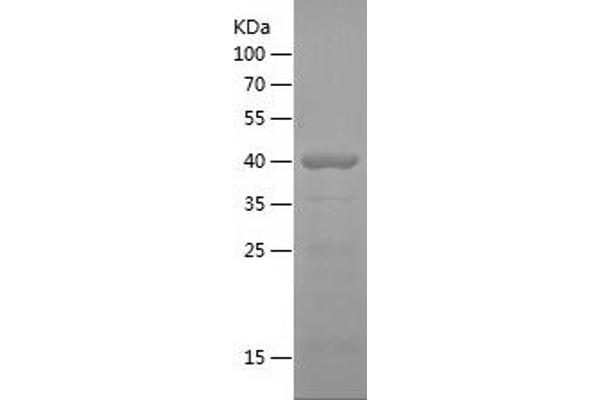 CTNNA2 Protein (AA 493-858) (His tag)