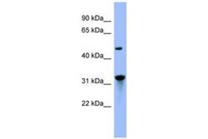 Image no. 1 for anti-Nitrilase 1 (NIT1) (AA 71-120) antibody (ABIN6741806) (Nitrilase 1 antibody  (AA 71-120))