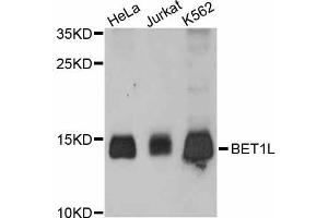 Western blot analysis of extracts of various cell lines, using BET1L antibody (ABIN5997300) at 1:3000 dilution.