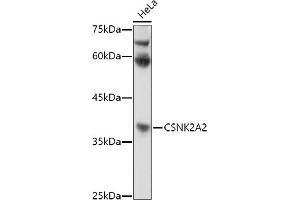 Western blot analysis of extracts of HeLa cells, using CSNK2 antibody (ABIN3022252, ABIN3022253, ABIN3022254 and ABIN6218695) at 1:1000 dilution. (CSNK2A2 antibody  (AA 1-350))