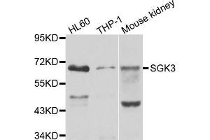 Western blot analysis of extracts of various cell lines, using SGK3 antibody (ABIN5974638) at 1/1000 dilution. (SGK3 antibody)