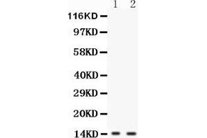 Anti-FABP6 antibody, Western blottingAll lanes: Anti FABP6  at 0.