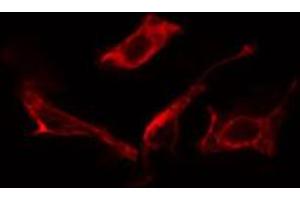ABIN6266758 staining NIH-3T3 cells by IF/ICC. (MAN1B1 antibody  (Internal Region))