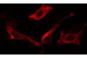 ABIN6266758 staining NIH-3T3 cells by IF/ICC. (MAN1B1 antibody  (Internal Region))