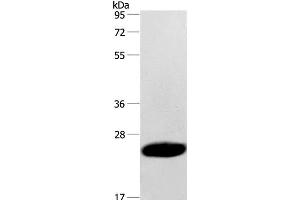 Western Blot analysis of Human fetal muscle tissue using CAV3 Polyclonal Antibody at dilution of 1:500 (Caveolin 3 antibody)