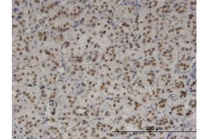 Immunoperoxidase of monoclonal antibody to TBX3 on formalin-fixed paraffin-embedded human adrenal gland. (TBX3 antibody  (AA 311-410))