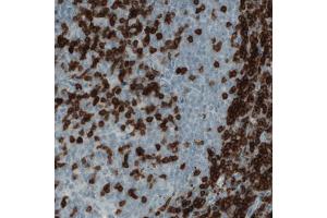 Immunohistochemical staining (Formalin-fixed paraffin-embedded sections) of human tonsil with CD3E monoclonal antibody, clone CL1497  shows strong positivity in a subset of lymphoid cells.