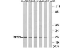 Western blot analysis of extracts from HepG2/COLO/HT-29/HeLa/HuvEc cells, using RPS9 Antibody. (RPS9 antibody  (AA 31-80))