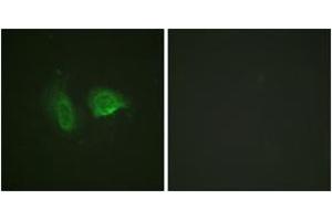 Immunofluorescence analysis of HeLa cells, using Calcium Sensing Receptor (Phospho-Thr888) Antibody.