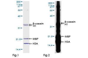 Kinase Activity Assay (KAA) image for Dual-Specificity tyrosine-(Y)-phosphorylation Regulated Kinase 3 (DYRK3) (AA 1-568) protein (GST tag) (ABIN1352210)