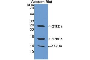 Detection of Recombinant CAMP, Human using Polyclonal Antibody to Cathelicidin Antimicrobial Peptide (CAMP)