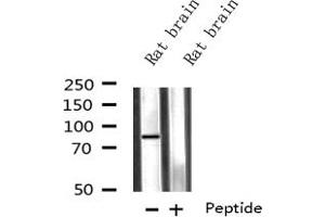 Western blot analysis on Rat brain lysate using CPT1C-specific antibody (CPT1C antibody)