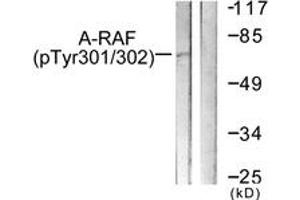 Western blot analysis of extracts from HeLa cells treated with PMA 125ng/ml 30', using A-RAF (Phospho-Tyr302) Antibody. (ARAF antibody  (pTyr302))