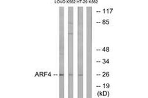 Western blot analysis of extracts from LOVO/K562/HT-29 cells, using ARF4 Antibody. (ARF4 antibody  (AA 71-120))