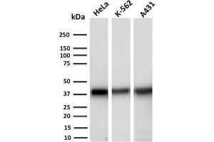 Western Blot Analysis of Human HeLa, K-562 and A431 cell lysates using AKR1C2 Mouse Monoclonal Antibody (CPTC-AKR1C2-1). (AKR1C2 antibody)