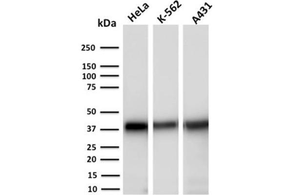 AKR1C2 抗体