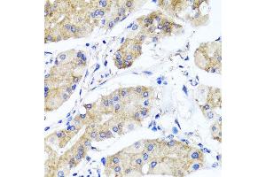 Immunohistochemistry of paraffin-embedded human gastric using PSTPIP1 antibody at dilution of 1:100 (x40 lens).