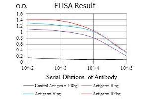 Black line: Control Antigen (100 ng), Purple line: Antigen(10 ng), Blue line: Antigen (50 ng), Red line: Antigen (100 ng), (ROCK1 antibody)