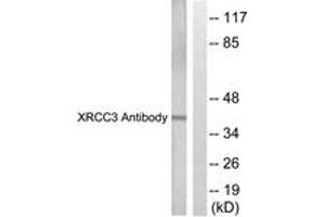 Western blot analysis of extracts from HepG2 cells, treated with Adriamycin 0. (RCC3 (AA 41-90) antibody)