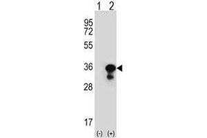 Western blot analysis of PCNA antibody and 293 cell lysate (2 ug/lane) either nontransfected (Lane 1) or transiently transfected (2) with the PCNA gene. (PCNA antibody  (AA 231-261))