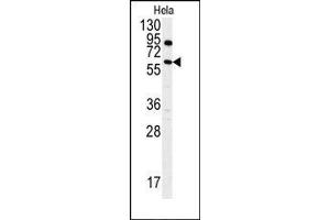 Image no. 1 for anti-anthrax Toxin Receptor 1 (ANTXR1) (AA 365-394), (Tyr382) antibody (ABIN360040) (ANTXR1 antibody  (Tyr382))