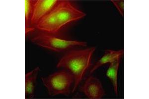 Immunofluorescence of human HeLa cells stained with Phalloidin-TRITC (Red) for Actin staining and UBE2S monoclonal antibody, clone AT2C12  (1 : 500) with Alexa 488 (Green). (UBE2S antibody  (AA 1-222))