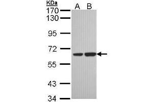 WB Image Sample (30 ug of whole cell lysate) A: H1299 B: Hela 7. (SNX18 antibody  (C-Term))