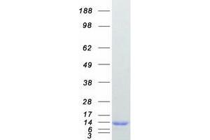 Validation with Western Blot (CSTA Protein (Myc-DYKDDDDK Tag))