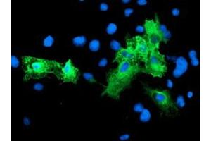 Anti-SCHIP1 mouse monoclonal antibody (ABIN2455665) immunofluorescent staining of COS7 cells transiently transfected by pCMV6-ENTRY SCHIP1 (RC206269). (SCHIP1 antibody)