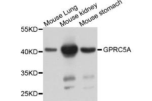 Western blot analysis of extracts of various cell lines, using GPRC5A antibody (ABIN5974510) at 1/1000 dilution. (GPRC5A antibody)
