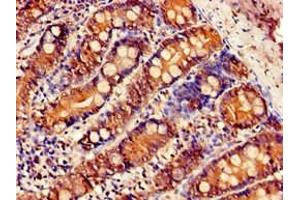 Immunohistochemistry of paraffin-embedded human small intestine tissue using ABIN7170011 at dilution of 1:100 (SLC5A1 antibody  (AA 564-643))