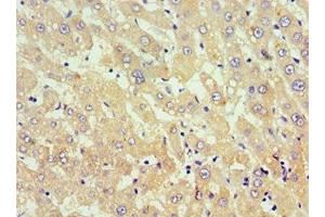 Immunohistochemistry of paraffin-embedded human liver tissue using ABIN7173812 at dilution of 1:100 (TNFSF18 antibody  (AA 72-199))