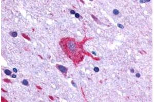 Immunohistochemical (Formalin/PFA-fixed paraffin-embedded sections) staining in human brain, neurons and glia with LGR4 polyclonal antibody . (LGR4 antibody  (C-Term))