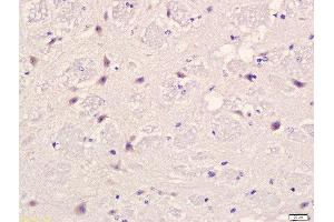 Formalin-fixed and paraffin embedded mouse brain labeled with Anti-PLAUR Polyclonal Antibody, Unconjugated  at 1:200 followed by conjugation to the secondary antibody and DAB staining. (PLAUR antibody  (AA 201-300))