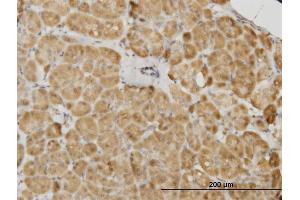 Immunoperoxidase of monoclonal antibody to PDK2 on formalin-fixed paraffin-embedded human pancreas. (PDK2 antibody  (AA 187-276))