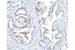 Immunohistochemistry (IHC) image for anti-BMI1 Polycomb Ring Finger Oncogene (BMI1) (AA 250-300) antibody (ABIN7455106) (Recombinant BMI1 antibody  (AA 250-300))