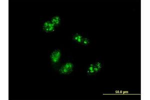Immunofluorescence of monoclonal antibody to TCOF1 on HeLa cell. (TCOF1 antibody  (AA 2-82))