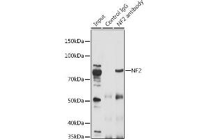 Immunoprecipitation analysis of 200 μg extracts of A-549 cells using 3 μg NF2 antibody (ABIN6128276, ABIN6144549, ABIN6144552 and ABIN6217696). (Merlin antibody  (AA 477-576))