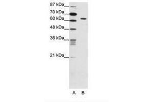 Image no. 1 for anti-SMAD, Mothers Against DPP Homolog 1 (SMAD1) (C-Term) antibody (ABIN202590) (SMAD1 antibody  (C-Term))