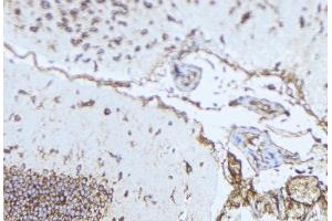 ABIN6276984 at 1/100 staining Mouse brain tissue by IHC-P. (Norrie Disease (Pseudoglioma) antibody)