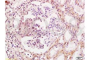 Formalin-fixed and human kidney tissue labeled with Anti-WT-1/Wilms Tumor Protein Polyclonal Antibody, Unconjugated (ABIN1386293) at 1:200 followed by conjugation to the secondary antibody and DAB staining (WT1 antibody  (AA 301-400))