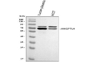 Western blot analysis of ANGPTL4 using anti-ANGPTL4 antibody (ABIN5518734). (ANGPTL4 antibody  (C-Term))