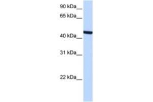 Western Blotting (WB) image for anti-Zinc Finger, C3HC-Type Containing 3 (ZCCHC3) antibody (ABIN2463365) (ZCCHC3 antibody)