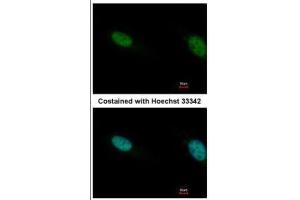 ICC/IF Image Immunofluorescence analysis of paraformaldehyde-fixed HeLa, using PB1, antibody at 1:500 dilution. (Polybromo 1 antibody  (N-Term))