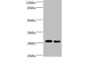 Western blot All lanes: Tumor necrosis factor antibody at dilution of 1: 1000 Lane 1: Tumor necrosis factor protein at 0. (TNF alpha antibody  (AA 78-234))