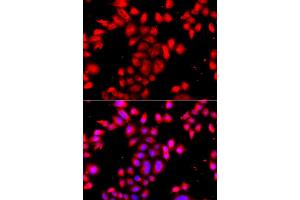 Immunofluorescence analysis of A549 cell using OSGEPL1 antibody. (OSGEPL1 antibody)