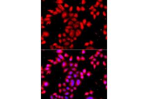 Immunofluorescence analysis of A549 cell using OSGEPL1 antibody. (OSGEPL1 antibody)